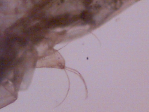 microinvertebrato? Copepode - con uova?